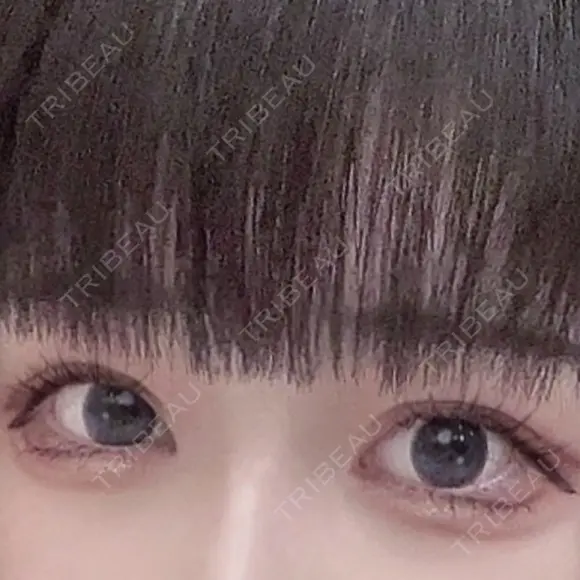 二重切開 / 目頭切開 / 上まぶたたるみ取り サラ美容外科 AFTER メイン用