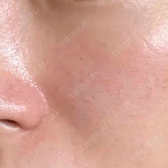 ヴェルヴェットスキン STARS CLINIC AFTER メイン用