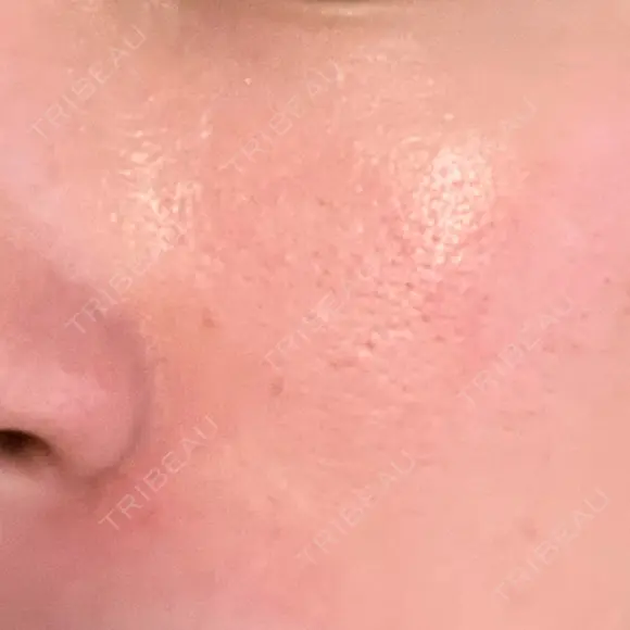 ヴェルヴェットスキン STARS CLINIC DAY 1 メイン用