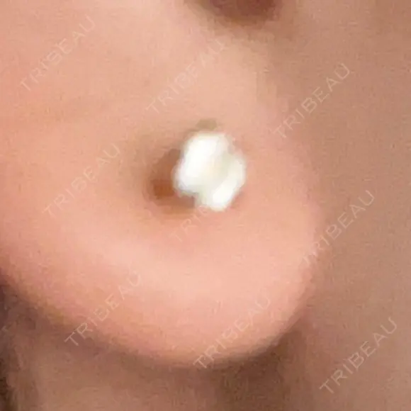 ピアス穴あけ 渋谷美容外科クリニック 渋谷院 AFTER メイン用