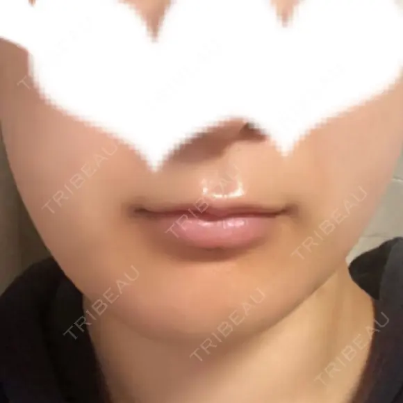 その他（輪郭） リラ・クラニオフェイシャル・クリニック DAY 553 メイン用