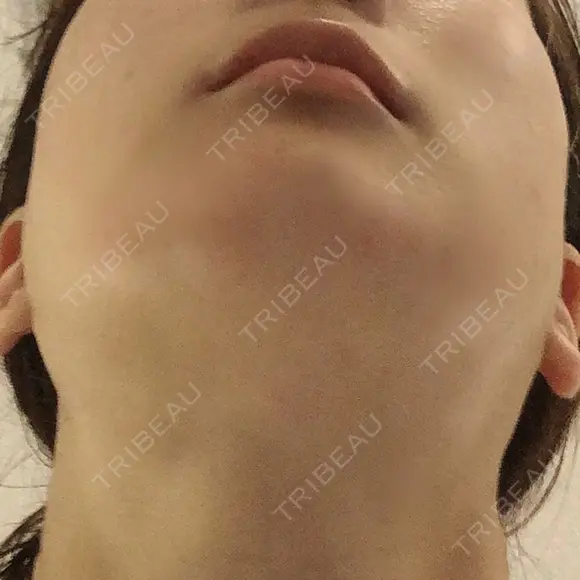 その他（輪郭） リラ・クラニオフェイシャル・クリニック DAY 553 メイン用