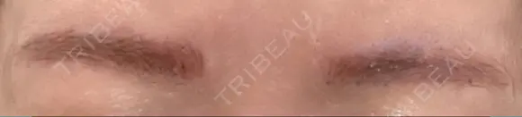 アートメイク（眉） TRUE DESIGN CLINIC DAY 0 メイン用