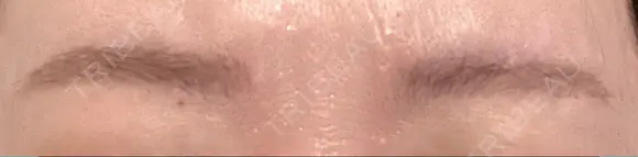 アートメイク（眉） TRUE DESIGN CLINIC AFTER メイン用