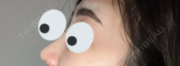 アートメイク（眉） TRUE DESIGN CLINIC DAY 2 メイン用