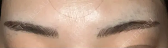 アートメイク（眉） TRUE DESIGN CLINIC DAY 3 メイン用