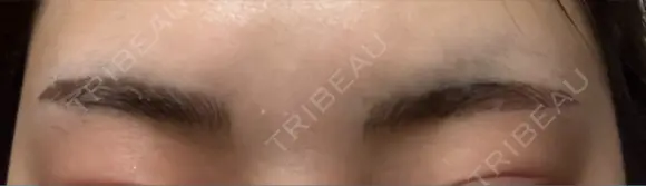 アートメイク（眉） TRUE DESIGN CLINIC DAY 4 メイン用