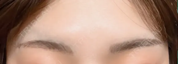 アートメイク（眉） TRUE DESIGN CLINIC DAY 5 メイン用