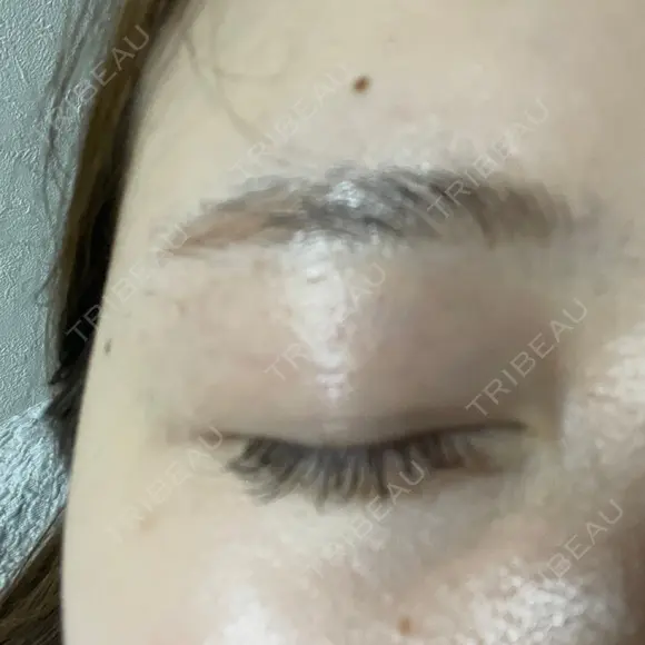 その他（目元） TRUE DESIGN CLINIC AFTER メイン用