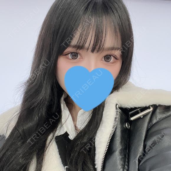 目頭切開 / クマ治療 / タレ目形成・グラマラスライン（切開） HAAB×DREAM BEAUTY CLINIC 大阪梅田院 DAY 31 メイン用