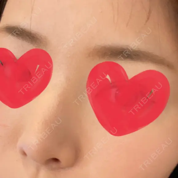 アートメイク（眉） メディカルアートメイク大阪 AFTER メイン用