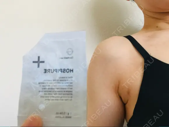 ハイフ（背中・ブラファット） 湘南美容クリニック 横浜院 DAY 93 メイン用