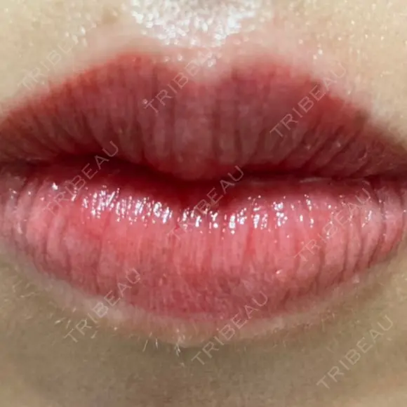 アートメイク（唇） こいずみ形成クリニック名古屋 DAY 0 メイン用