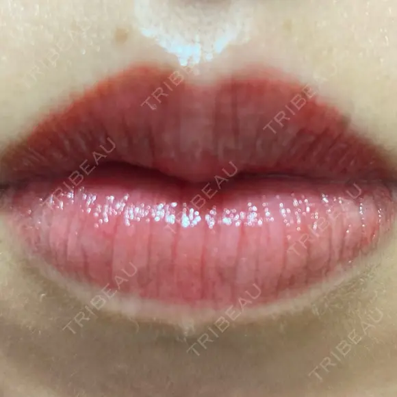 アートメイク（唇） こいずみ形成クリニック名古屋 DAY 1 メイン用