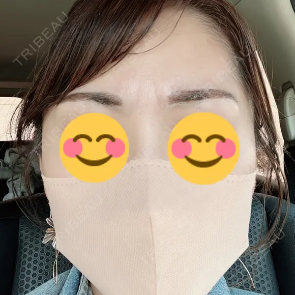 アートメイク（眉） TRUE DESIGN CLINIC DAY 2 メイン用