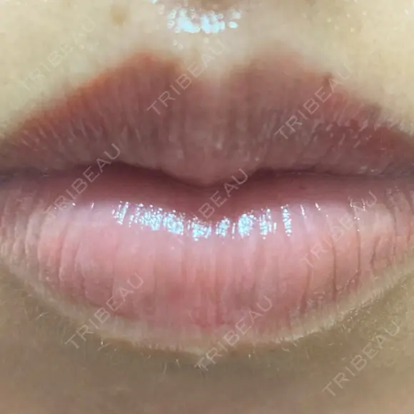 アートメイク（唇） こいずみ形成クリニック名古屋 DAY 4 メイン用