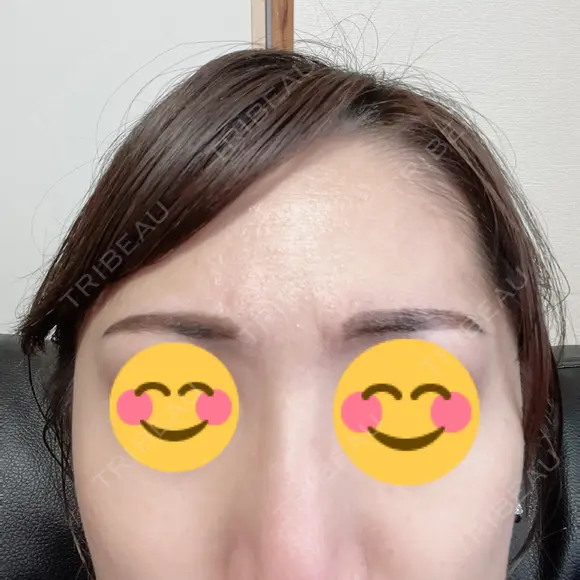 アートメイク（眉） TRUE DESIGN CLINIC DAY 3 メイン用