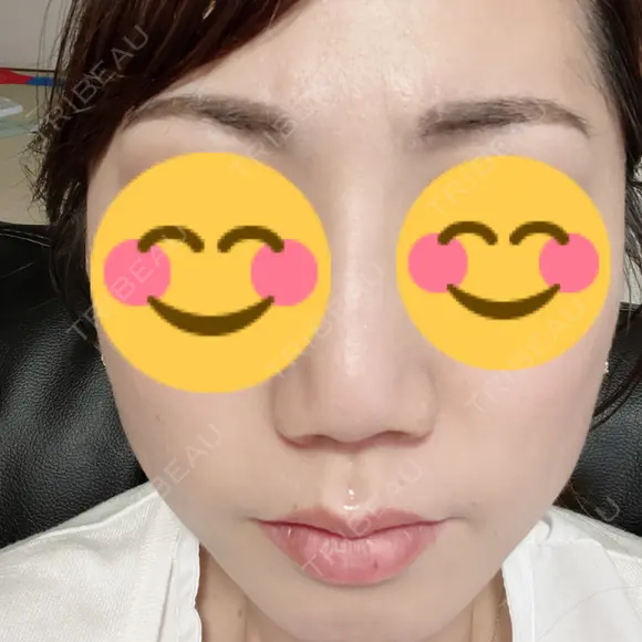 アートメイク（眉） TRUE DESIGN CLINIC DAY 5 メイン用