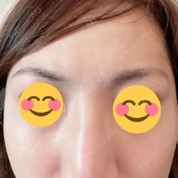 アートメイク（眉） TRUE DESIGN CLINIC AFTER メイン用