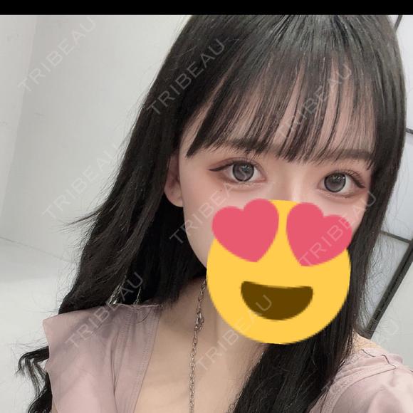 目頭切開 / クマ治療 / タレ目形成・グラマラスライン（切開） HAAB×DREAM BEAUTY CLINIC 大阪梅田院 DAY 21 メイン用