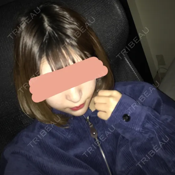 あごプロテーゼ 恵聖会クリニック 京橋院 DAY 39 メイン用