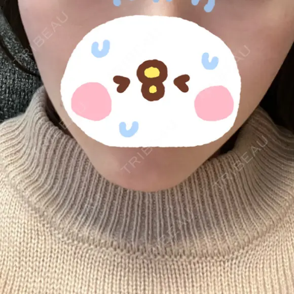 脂肪溶解注射（顔） LIGHT CLINIC 【ライトクリニック】 名古屋院 DAY 1 メイン用