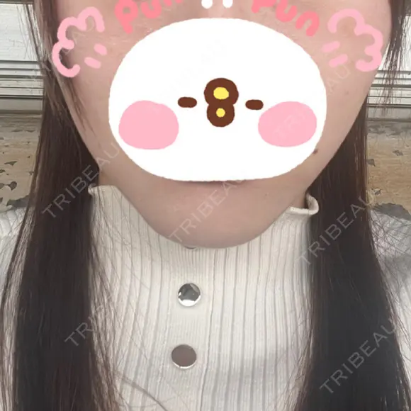 脂肪溶解注射（顔） LIGHT CLINIC 【ライトクリニック】 名古屋院 DAY 6 メイン用