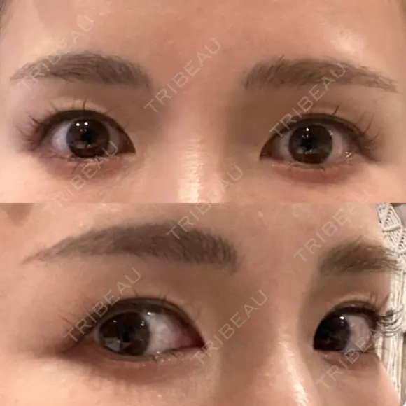 アートメイク（眉） ハナビューティークリニック AFTER メイン用