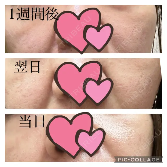 ポテンツァ GAYA body design clinic AFTER メイン用