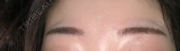 アートメイク（眉） メディカルアートメイク大阪 AFTER メイン用