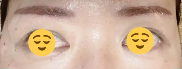 アートメイク（眉） メディカルアートメイク大阪 DAY 48 メイン用