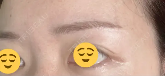 アートメイク（眉） メディカルアートメイク大阪 DAY 56 メイン用