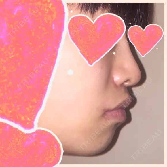 セットバック 大塚美容形成外科・歯科 大塚本院 BEFORE メイン用