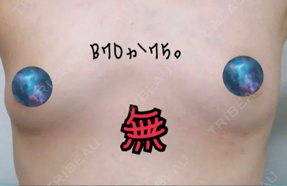 脂肪吸引（お腹） / 脂肪吸引（お尻） / 豊胸（脂肪注入） / その他（ボディ） ドクターフィット（Dr.fit）クリニック BEFORE メイン用