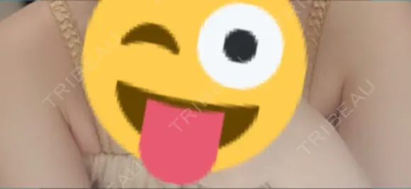 脂肪吸引（お腹） / 脂肪吸引（お尻） / 豊胸（脂肪注入） / その他（ボディ） ドクターフィット（Dr.fit）クリニック BEFORE メイン用