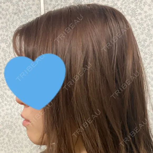 骨切り（あご） / バッカルファット除去 / 脂肪吸引（顔） / セットバック アーククリニック BEFORE メイン用