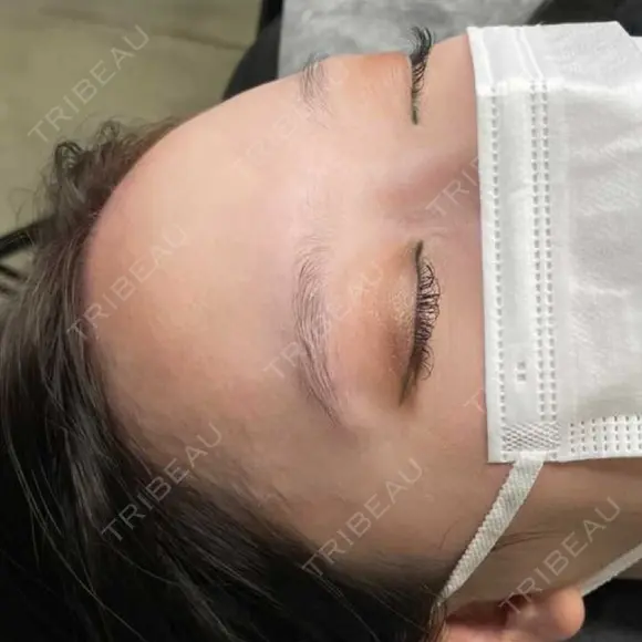 アートメイク（眉） MURAL CLINIC BEFORE メイン用