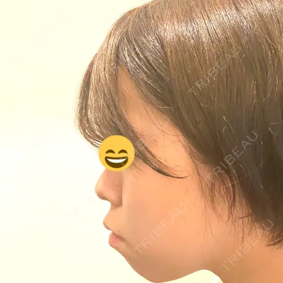セットバック 大塚美容形成外科・歯科 大塚本院 BEFORE メイン用