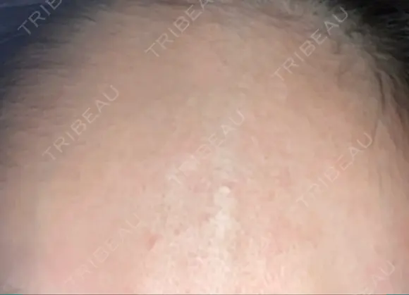 その他 Wクリニック 梅田院 BEFORE メイン用