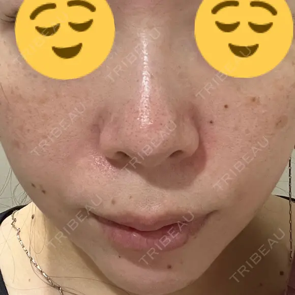 ルメッカ La Clinique Shinjuku 【ラクリニック 新宿】 BEFORE メイン用