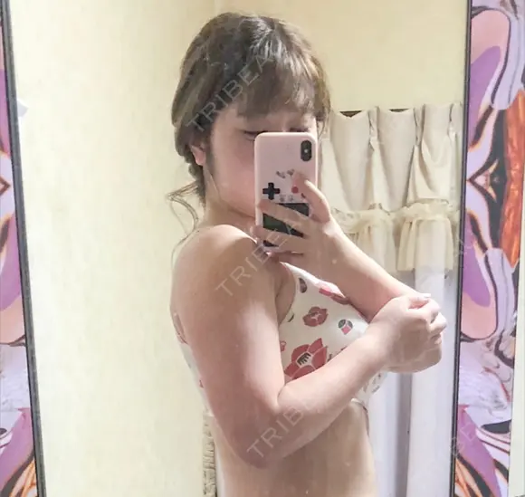 脂肪吸引（二の腕） ドクターフィット（Dr.fit）クリニック BEFORE メイン用