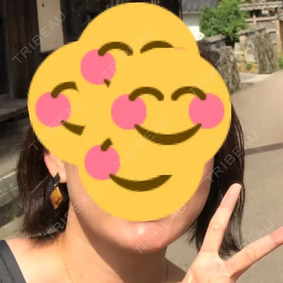 脂肪溶解注射（顔） 聖心美容クリニック 福岡院 BEFORE メイン用