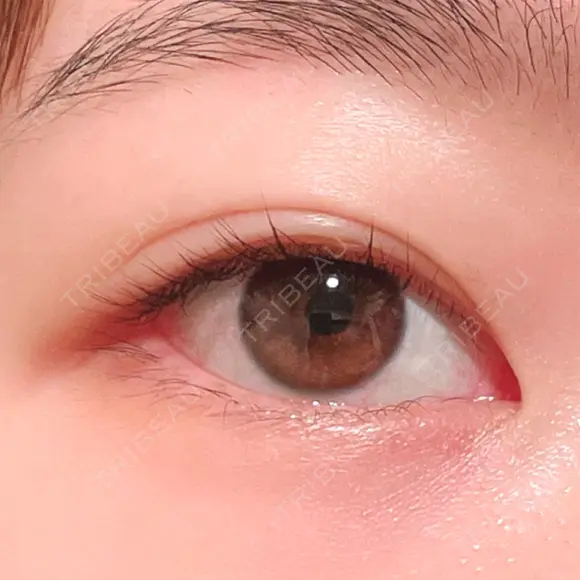 二重埋没 湘南美容クリニック 上野院 BEFORE メイン用