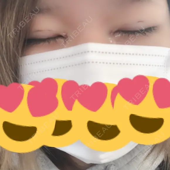 二重埋没 / 目頭切開 聖心美容クリニック 福岡院 BEFORE メイン用