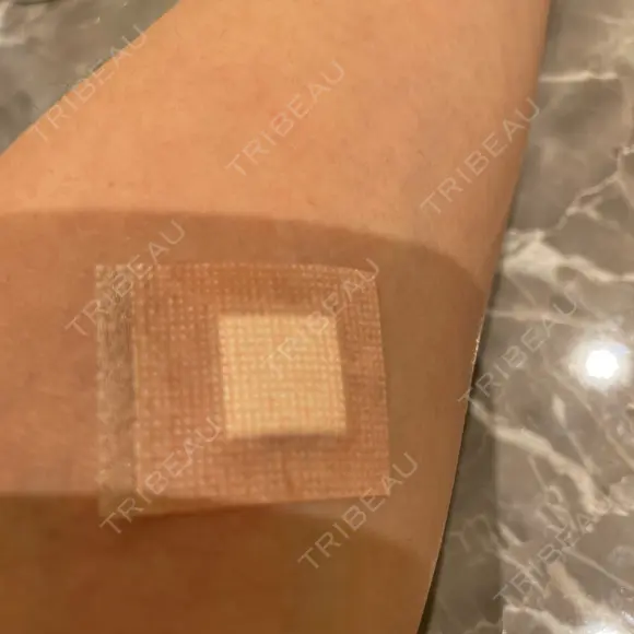 美容点滴・美容注射（疲労回復） シンデレラ＆ダヴィンチクリニック BEFORE メイン用