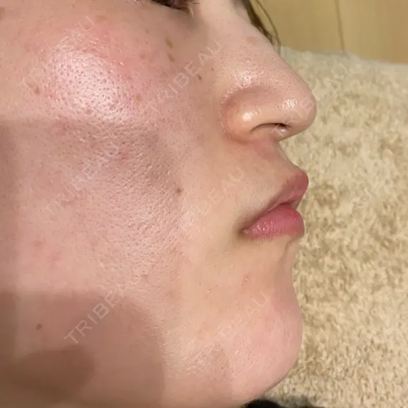 ポテンツァ レナータクリニック 立川院 BEFORE メイン用