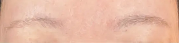 アートメイク（眉） TRUE DESIGN CLINIC BEFORE メイン用