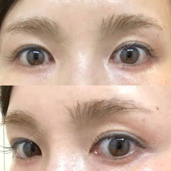アートメイク（眉） ハナビューティークリニック BEFORE メイン用