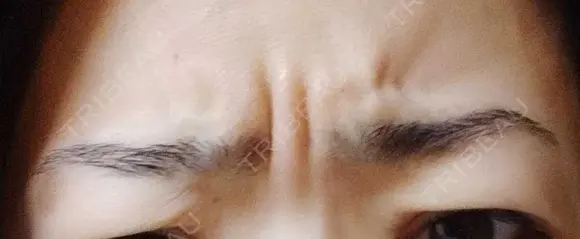 その他（肌） 湘南美容クリニック 宇都宮院 BEFORE メイン用