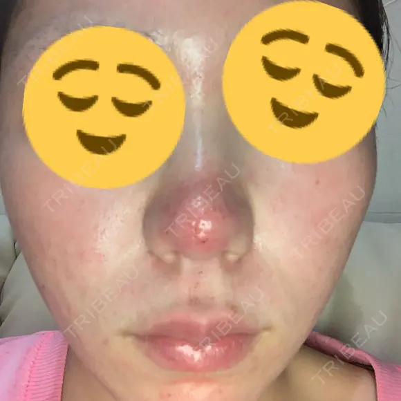 ポテンツァ レナータクリニック 立川院 BEFORE メイン用